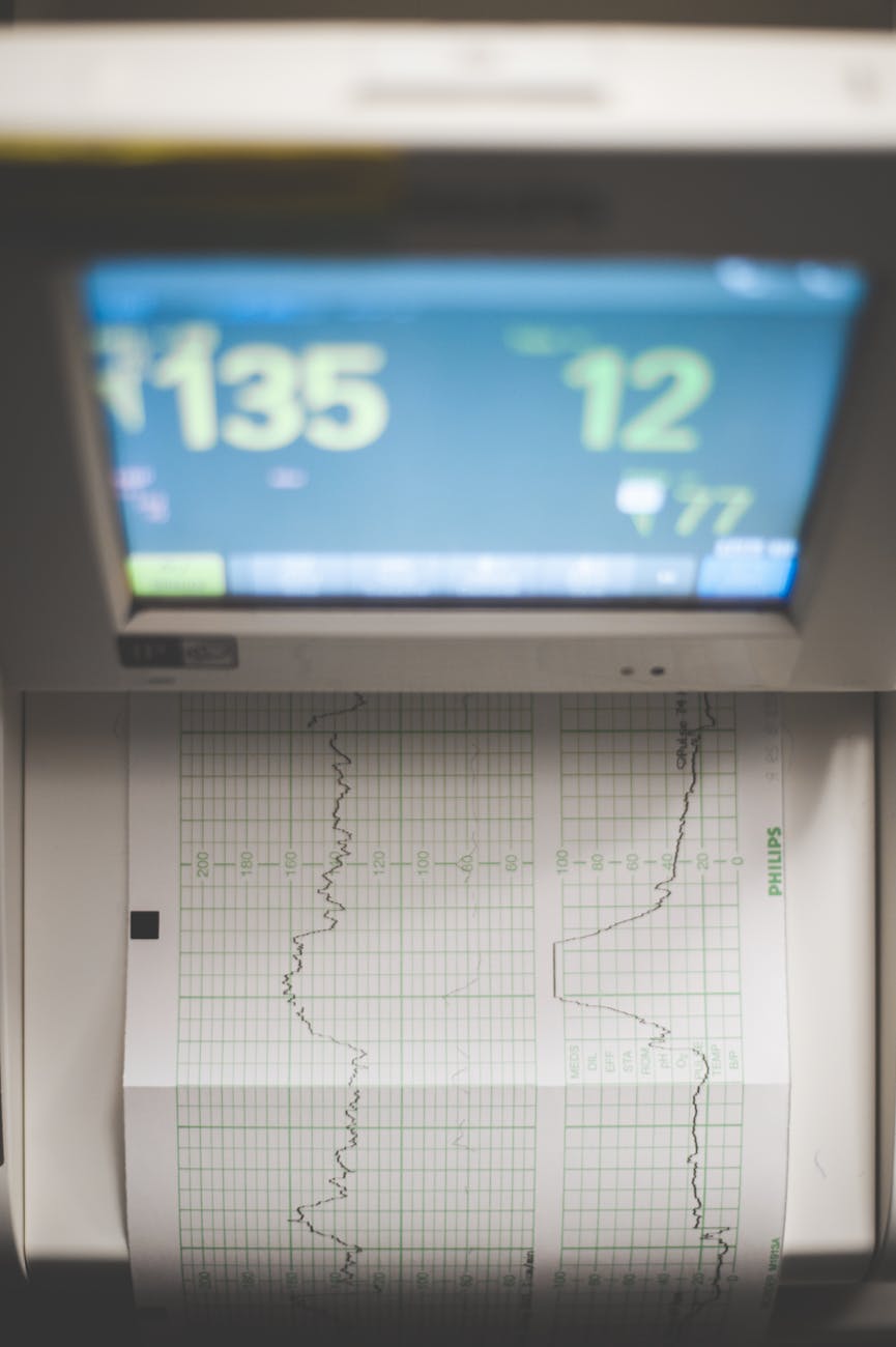 Medizinischer Monitor mit grünem Gitter, im Vordergrund ein bedruckter Polysomnographie-Streifen.